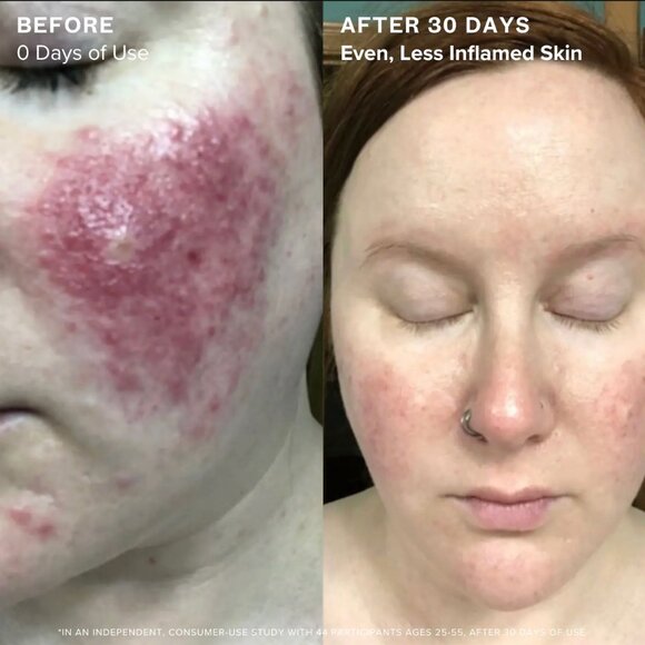 NWT MARA 1.2% Clean Algae Retinol Face Oil for Anti-Aging and Wrinkles with Gre - Picture 3 of 8